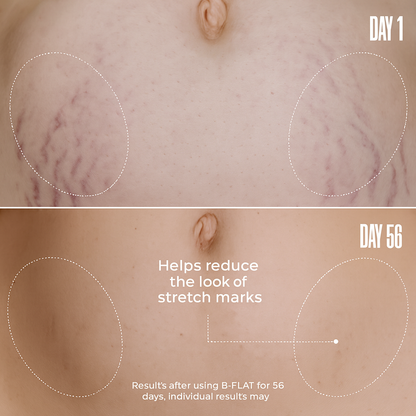 B-FLAT Belly Firming Cream